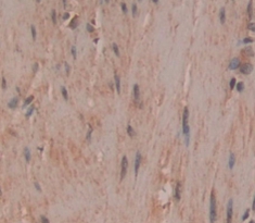 Polyclonal Antibody to Tau-Tubulin Kinase 2 (tTBK2)