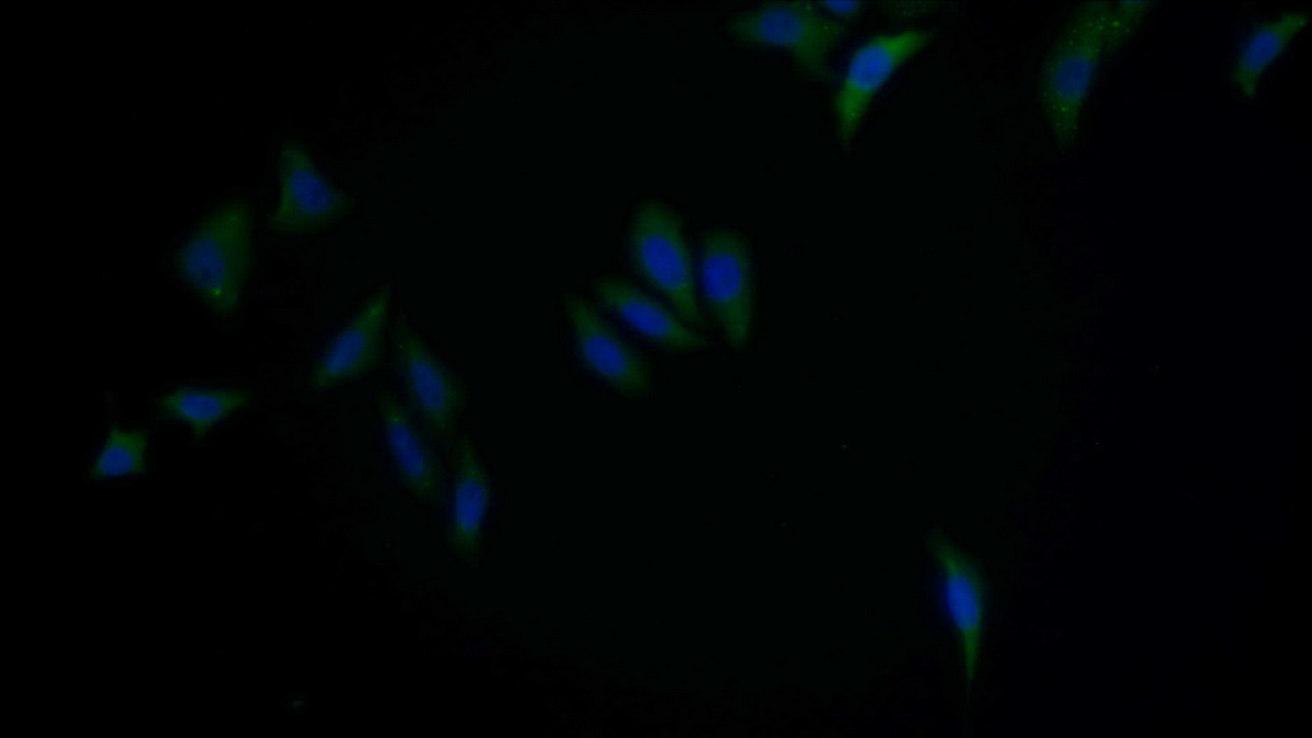 Polyclonal Antibody to Karyopherin Alpha 2 (KPNa2)