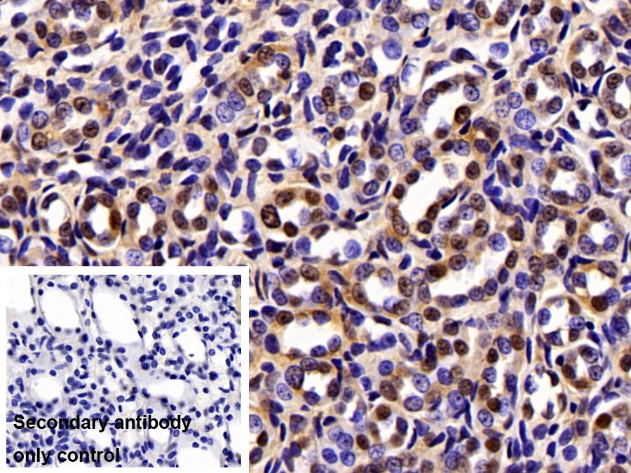 Polyclonal Antibody to Karyopherin Beta (KPNb1)