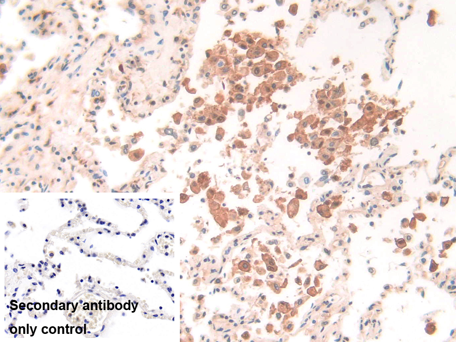 Polyclonal Antibody to Interferon Gamma Inducible Protein 30 (IFI30)