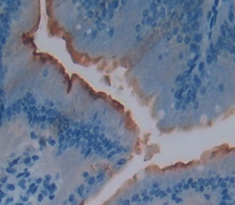 Polyclonal Antibody to Interleukin 22 Receptor (IL22R)