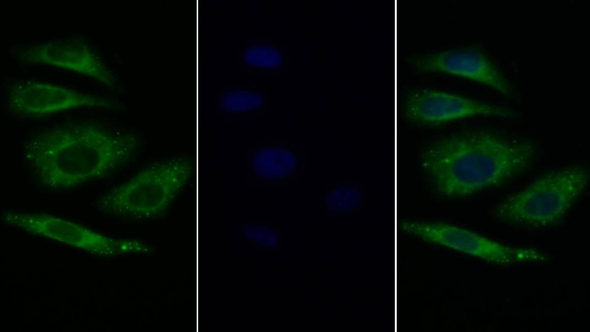 Polyclonal Antibody to Interleukin 20 Receptor Beta (IL20Rb)