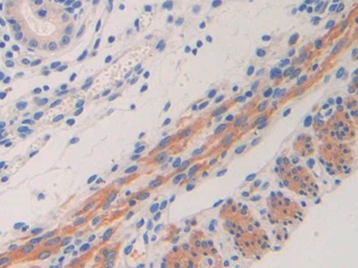 Polyclonal Antibody to Interleukin 11 Receptor Alpha (IL11Ra)