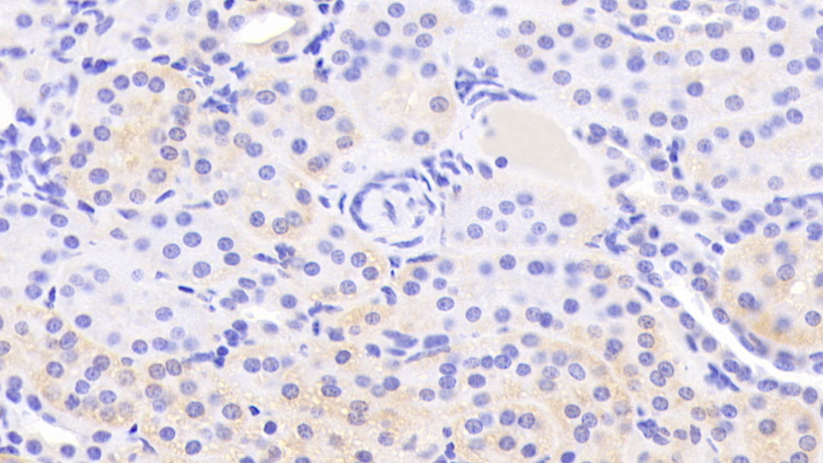 Polyclonal Antibody to Annexin A9 (ANXA9)