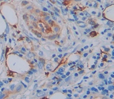 Polyclonal Antibody to Annexin A10 (ANXA10)