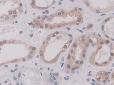 Polyclonal Antibody to Annexin A11 (ANXA11)