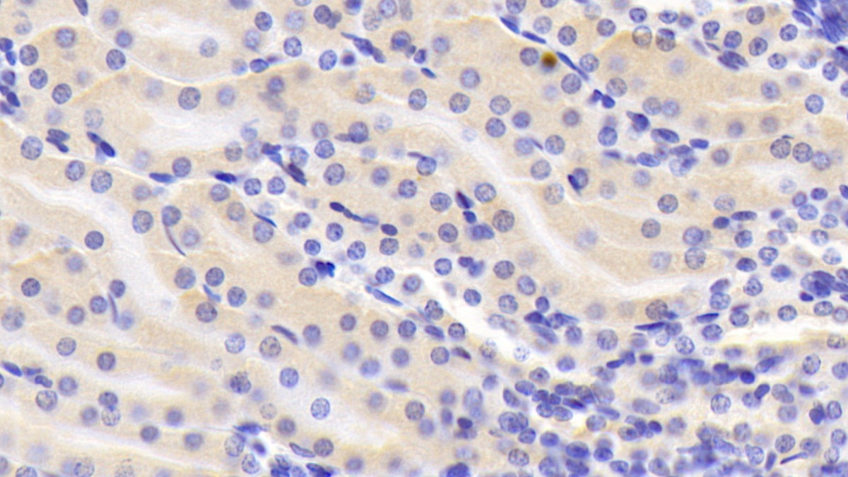 Polyclonal Antibody to Annexin A3 (ANXA3)