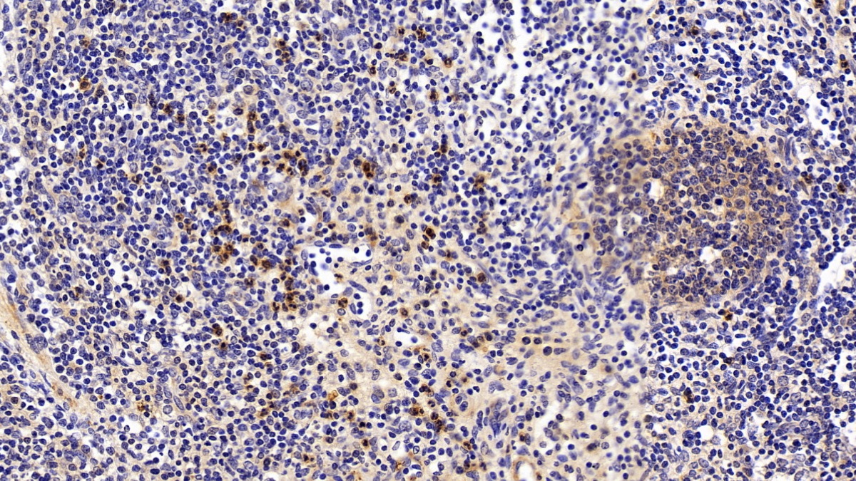 Polyclonal Antibody to Annexin A1 (ANXA1)