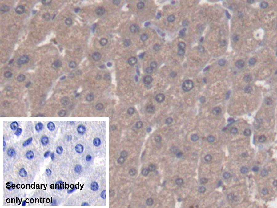 Polyclonal Antibody to Aldehyde Dehydrogenase 1 Family, Member A1 (ALDH1A1)