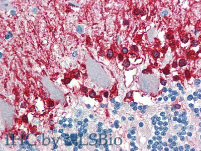 Polyclonal Antibody to Aldehyde Dehydrogenase 1 Family, Member A3 (ALDH1A3)