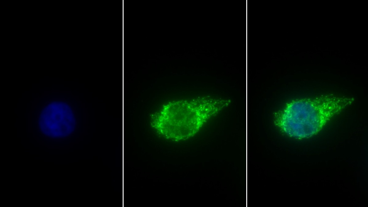 Polyclonal Antibody to Aldehyde Dehydrogenase 1 Family, Member B1 (ALDH1B1)