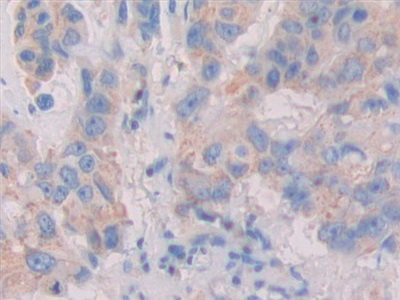 Polyclonal Antibody to Interleukin 1 Zeta (IL1z)