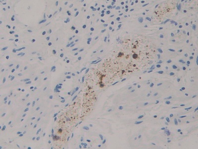 Polyclonal Antibody to Diacylglycerol Kinase Zeta (DGKz)