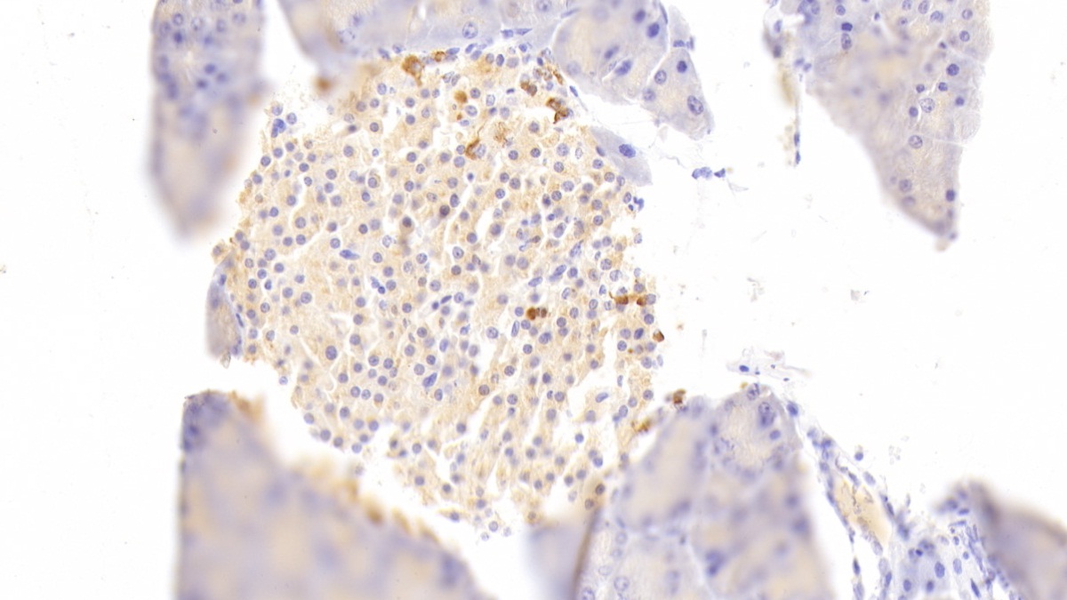 Polyclonal Antibody to Diacylglycerol Kinase Zeta (DGKz)