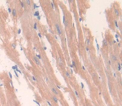 Polyclonal Antibody to Deoxyribonuclease X (DNASEX)