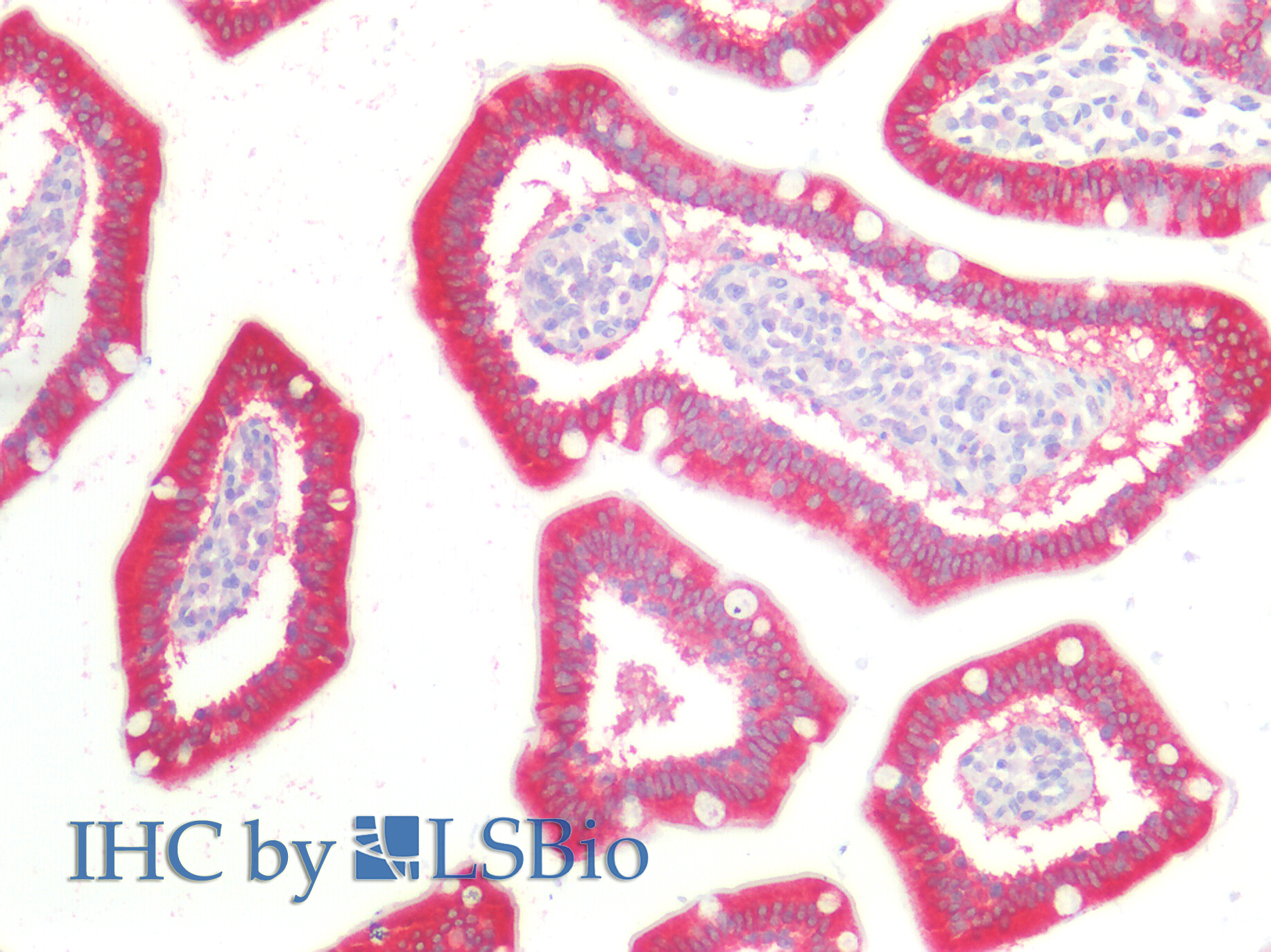 Polyclonal Antibody to Catenin Beta Interacting Protein 1 (CTNNbIP1)