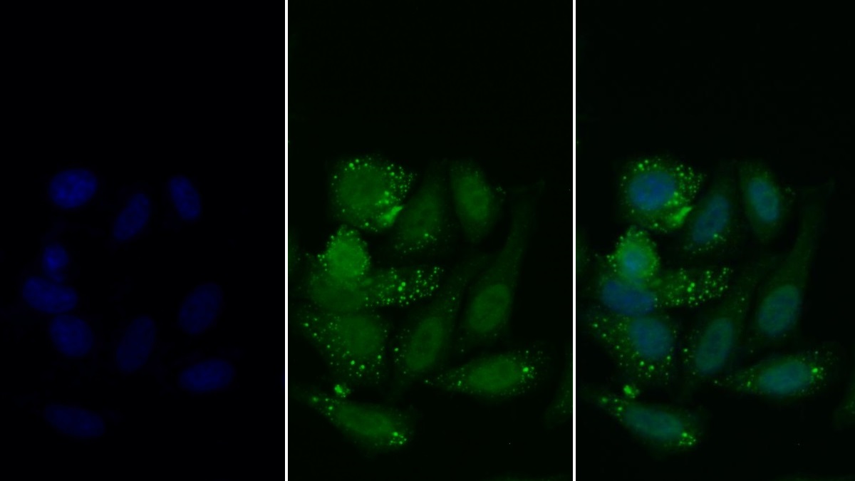 Polyclonal Antibody to Histone Deacetylase 6 (HDAC6)