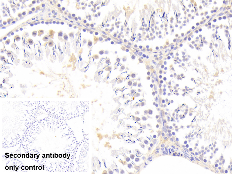 Polyclonal Antibody to Sirtuin 4 (SIRT4)