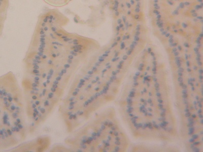 Polyclonal Antibody to Sirtuin 6 (SIRT6)