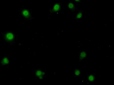 Polyclonal Antibody to Sirtuin 7 (SIRT7)