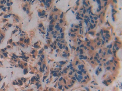 Polyclonal Antibody to Vav 3 Oncogene (VAV3)