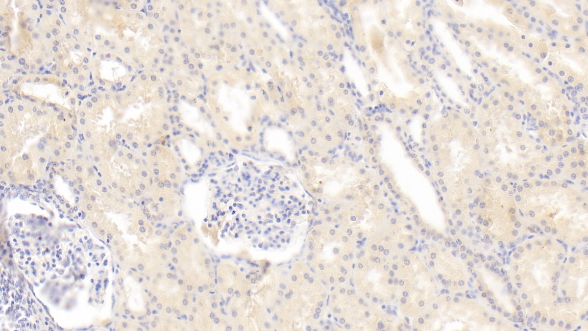 Polyclonal Antibody to Filamin B Beta (FLNb)