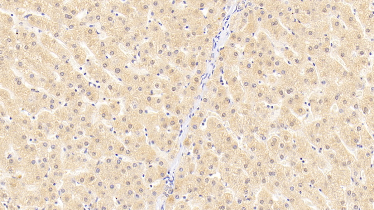 Polyclonal Antibody to Filamin B Beta (FLNb)