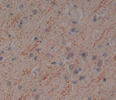 Polyclonal Antibody to Eukaryotic Translation Initiation Factor 2C1 (EIF2C1)