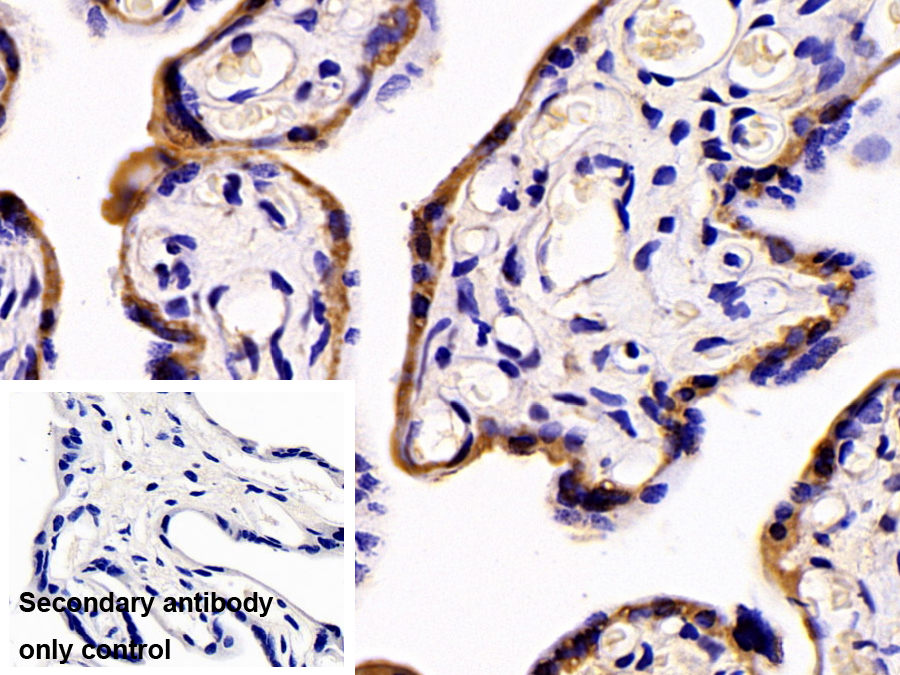 Polyclonal Antibody to Eukaryotic Translation Initiation Factor 4A1 (EIF4A1)