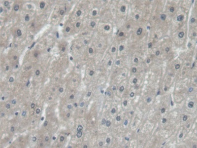 Polyclonal Antibody to Eukaryotic Translation Elongation Factor 1 Alpha 1 (EEF1a1)