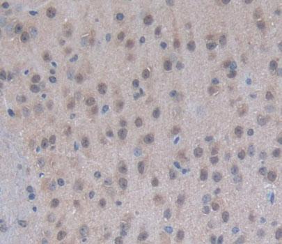 Polyclonal Antibody to Eukaryotic Translation Elongation Factor 1 Epsilon 1 (EEF1e1)