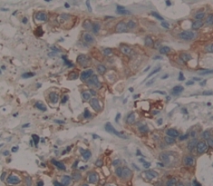 Polyclonal Antibody to Eukaryotic Translation Elongation Factor 1 Gamma (EEF1g)