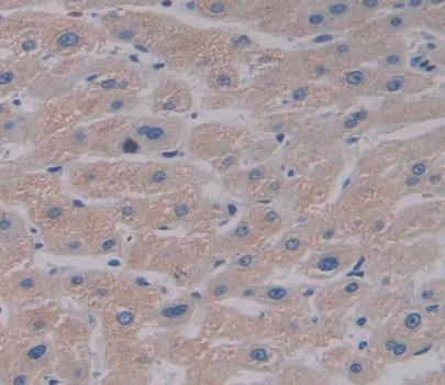 Polyclonal Antibody to Eukaryotic Elongation Factor 2 Kinase (EEF2K)