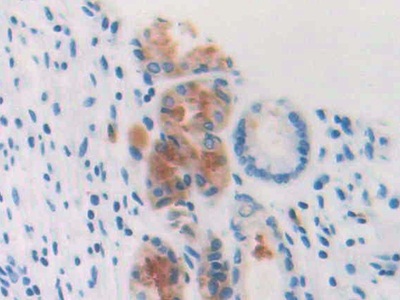 Polyclonal Antibody to Profilin 3 (PFN3)