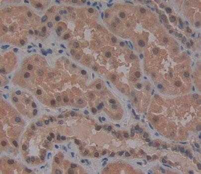 Polyclonal Antibody to Wilms Tumor Protein (WT1)