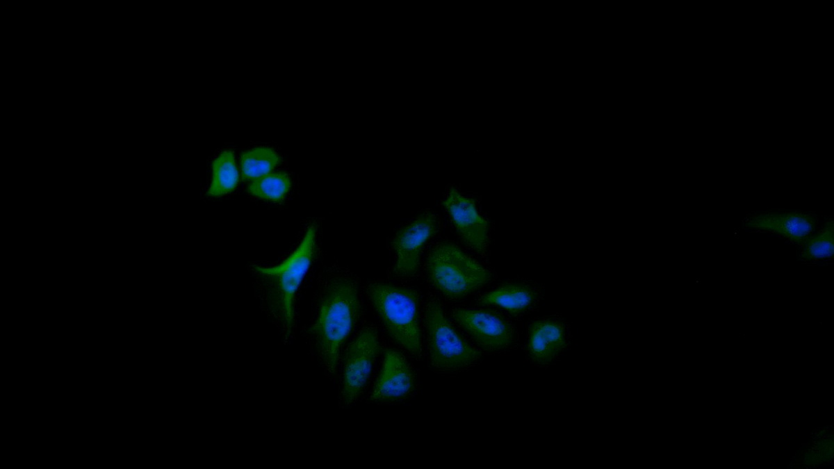 Polyclonal Antibody to Ubiquitin Specific Peptidase 8 (USP8)