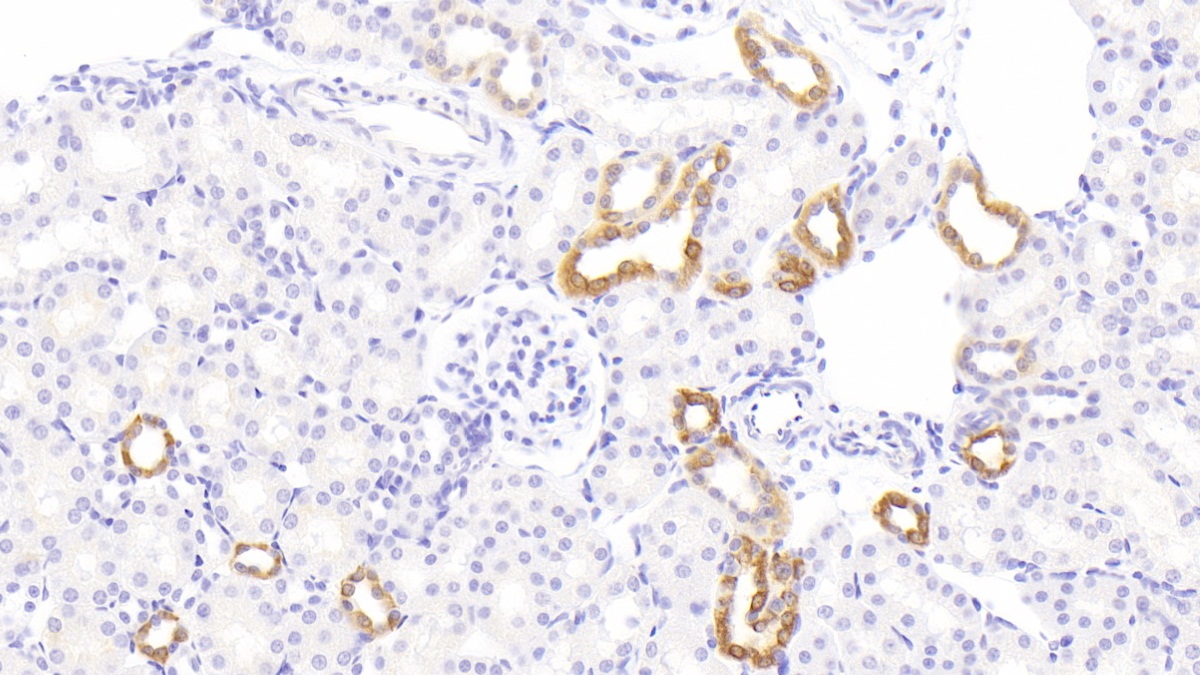 Polyclonal Antibody to 11-Beta-Hydroxysteroid Dehydrogenase Type 2 (HSD11b2)