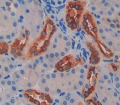 Polyclonal Antibody to Fucosyltransferase 8 (FUT8)