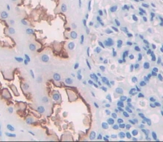 Polyclonal Antibody to Ectonucleotide Pyrophosphatase/Phosphodiesterase 1 (ENPP1)