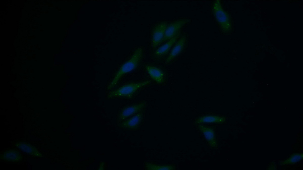 Polyclonal Antibody to Bcl2 Associated Athanogene 2 (BAG2)