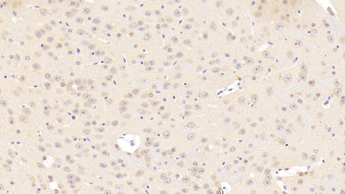 Polyclonal Antibody to Calcium Channel, Voltage Dependent, L-Type, Alpha 1C Subunit (CACNa1C)