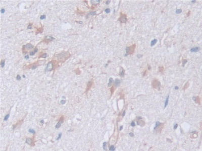 Polyclonal Antibody to Calpain, Small Subunit 1 (CAPNS1)