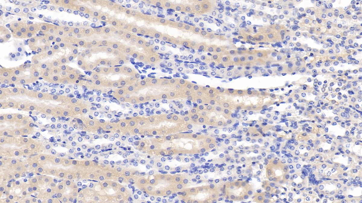 Polyclonal Antibody to Chloride Intracellular Channel Protein 4 (CLIC4)