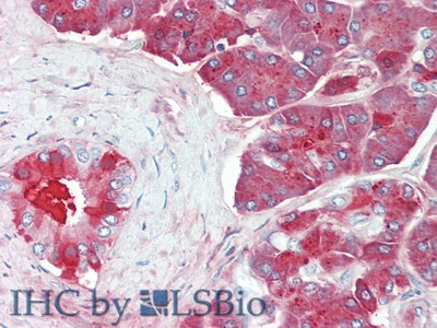 Polyclonal Antibody to Carboxypeptidase B1, Tissue (CPB1)