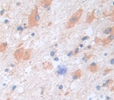 Polyclonal Antibody to Carboxypeptidase E (CPE)