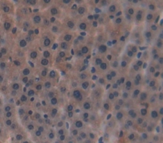 Polyclonal Antibody to Carboxypeptidase N1 (CPN1)