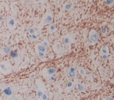 Polyclonal Antibody to Carboxypeptidase Z (CPZ)