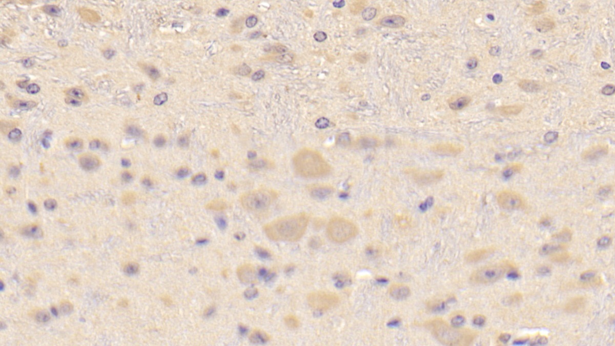 Polyclonal Antibody to Crystallin Beta A1 (CRYbA1)