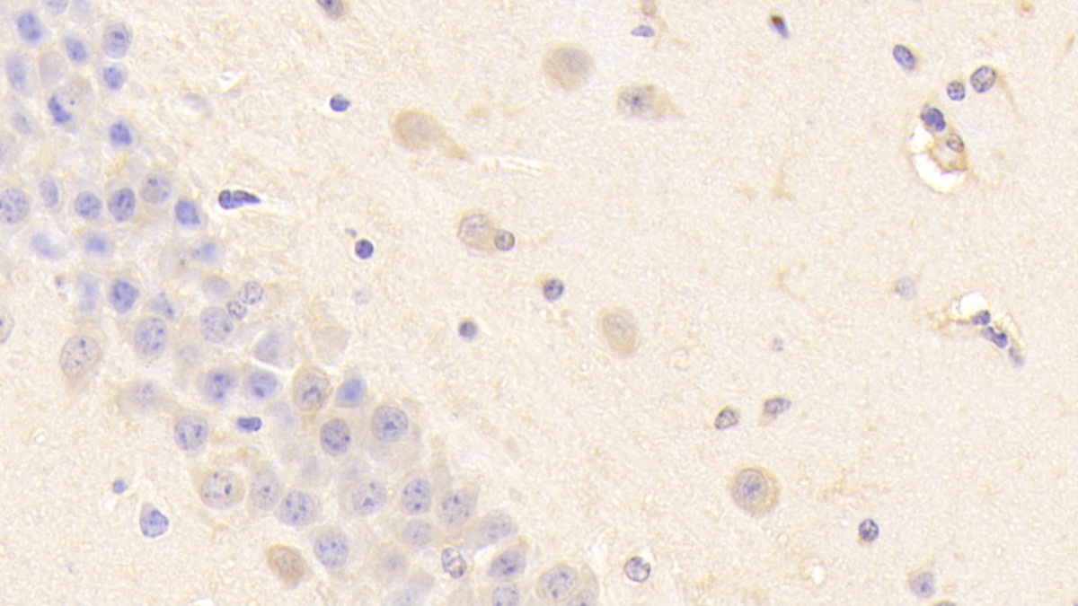 Polyclonal Antibody to Crystallin Gamma S (CRYgS)