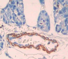 Polyclonal Antibody to Carnitine Palmitoyltransferase 1B, Muscle (CPT1B)